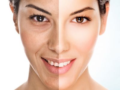 Ce trebuie sa mananci pentru o piele sanatoasa, stralucitoare si mai tanara?