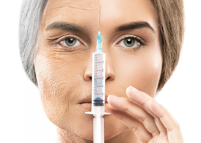 Tratament bioregenerator ProFhilo