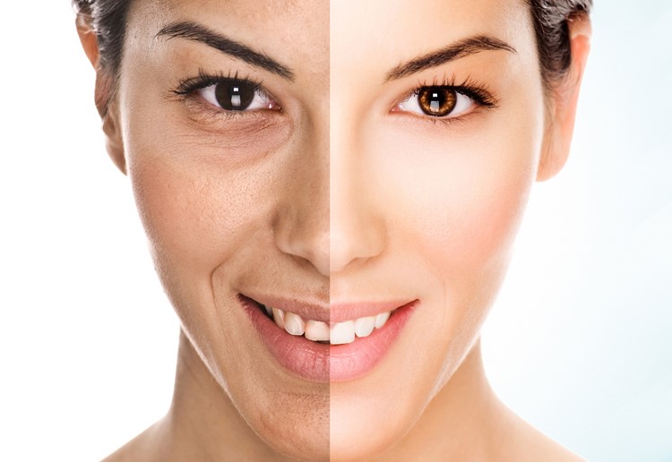 Ce trebuie sa mananci pentru o piele sanatoasa, stralucitoare si mai tanara?