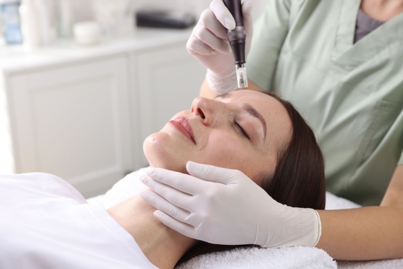 Mezoterapie faciala vs. microneedling: diferente, rezultate si cum alegi corect pentru tenul tau