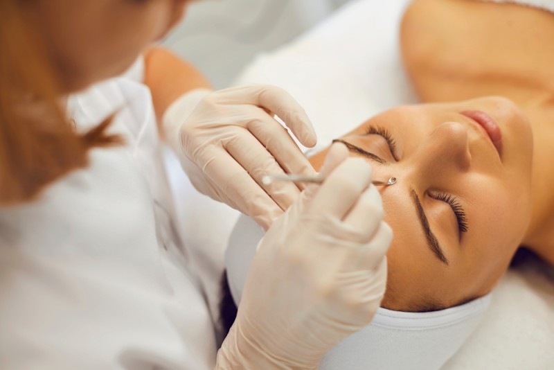 Extractie puncte negre cu tehnologia Hydrafacial: De ce este mai sigura decât metoda clasica